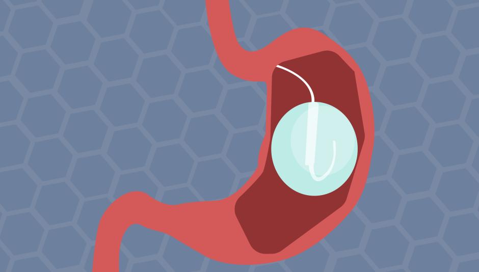 Médico usa modelo de intestino para explicar informações