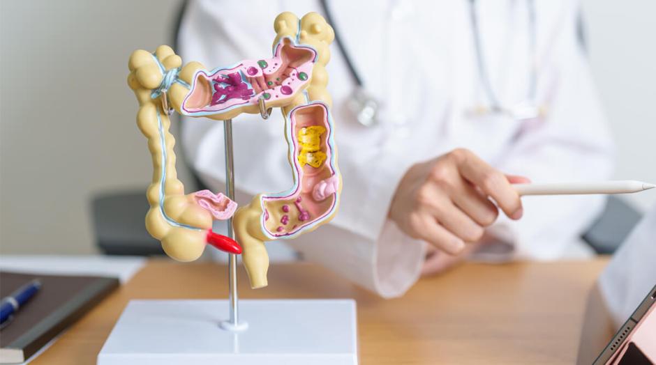 Médico usa modelo de colo educativo para explicar informações