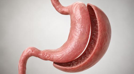 Gastroplastia: Onde Fazer? Guia Completo Para Escolher Com Segurança