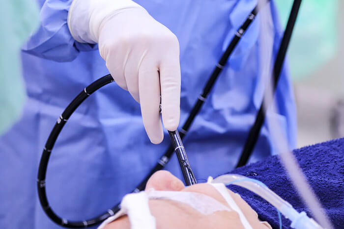 Onde Fazer Endoscopia em Brasilia DF?